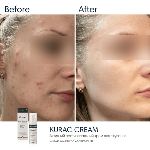 Нічний крем з бензоїл пероксидом Braderm Kurac Cream, 30 мл 110025 фото