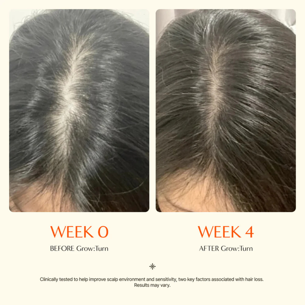 Стимулююча сироватка-ампула для росту волосся з екзосомами Lilyeve Grow Turn Exosome Brush Ampoule, 100 мл 11001239 фото