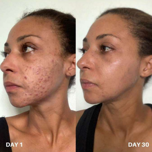 Очищувач для шкіри Clinisoothe+ Skin Purifier, 100 мл 11455 фото