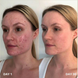 Очищувач для шкіри Clinisoothe+ Skin Purifier, 100 мл 11455 фото 5